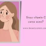 is vitamin c good for acne prone skin? Or it is bad?