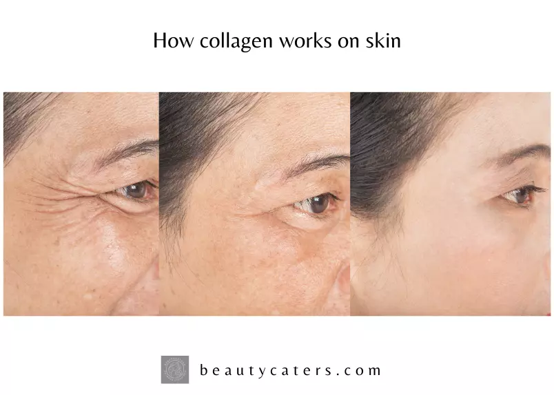 skin improvement before and after using collagen