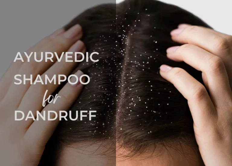 Best Ayurvedic Shampoo for Dandruff