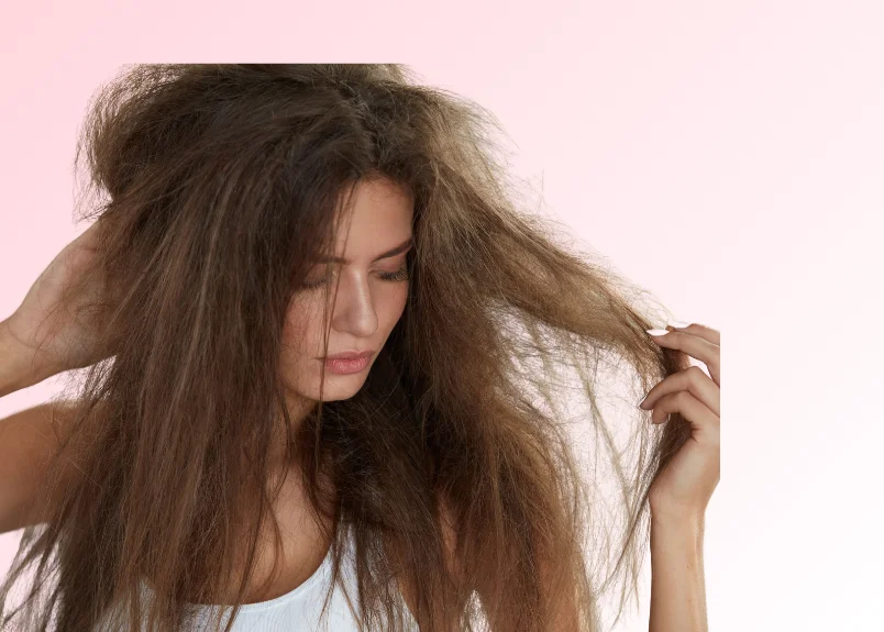 Woman with dry and frizzy hair- Effect of over-shampooing