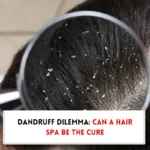 Dandruff shown in magnified version indicating "does hair spa remove dandruff?"