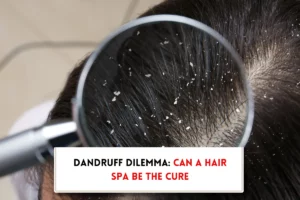 Dandruff shown in magnified version indicating "does hair spa remove dandruff?"