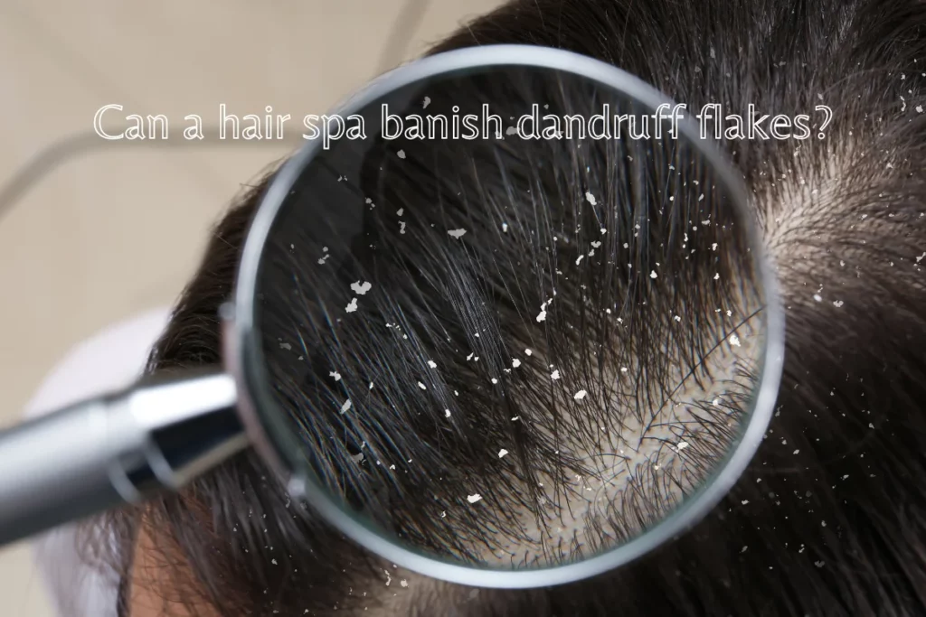 Dandruff shown in magnified version indicating "does hair spa remove dandruff?"