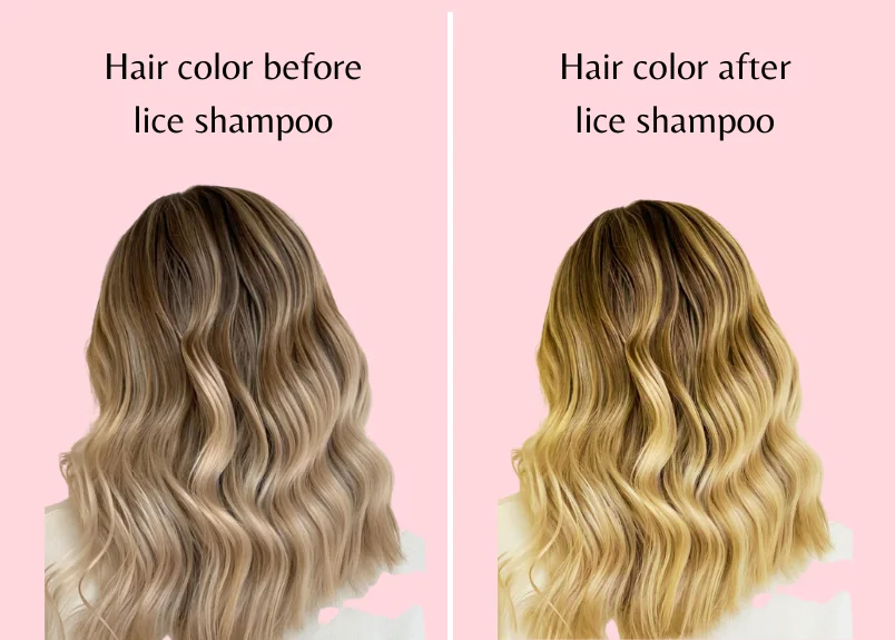 Effects of lice shampoo on hair color